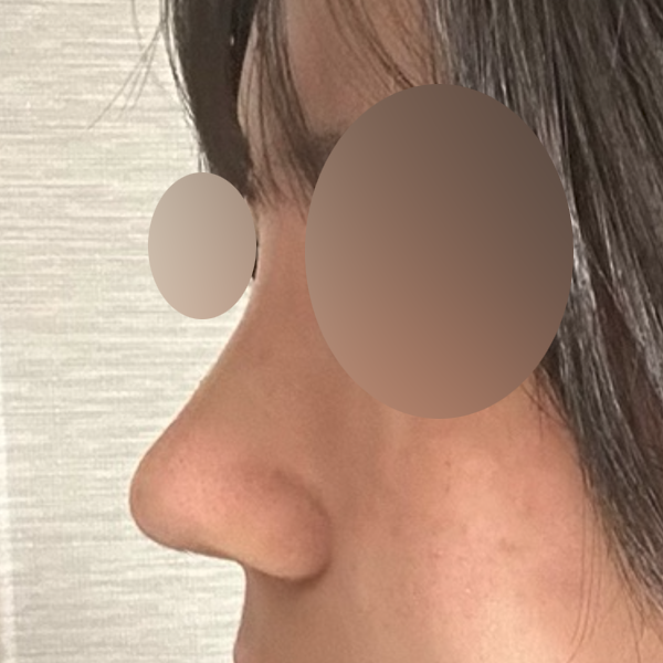 수술 전 후