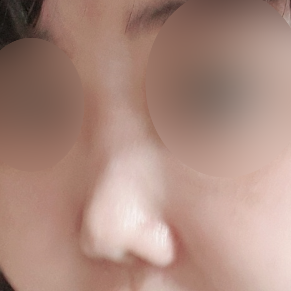 수술 전 후