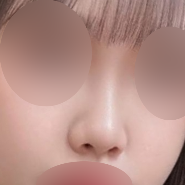 수술 전 후