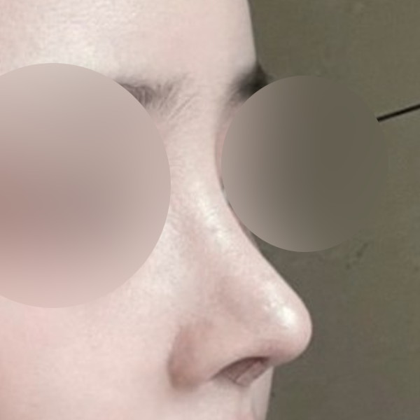 수술 전 후