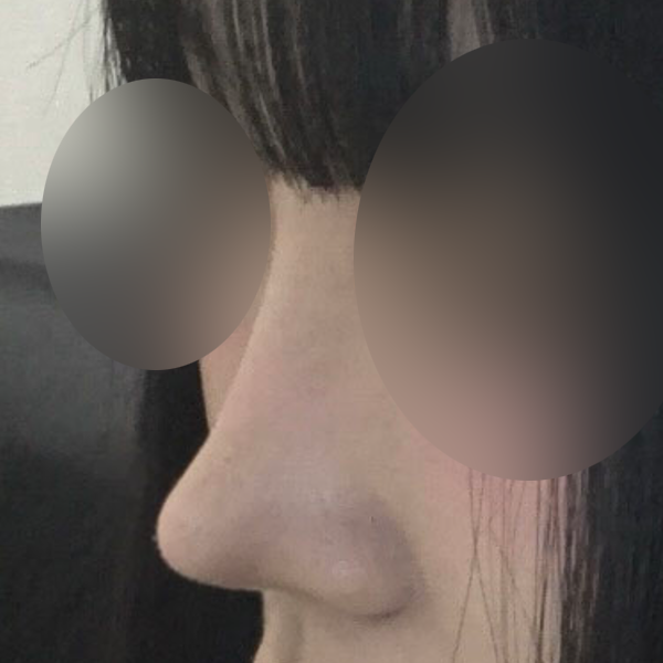 수술 전 후