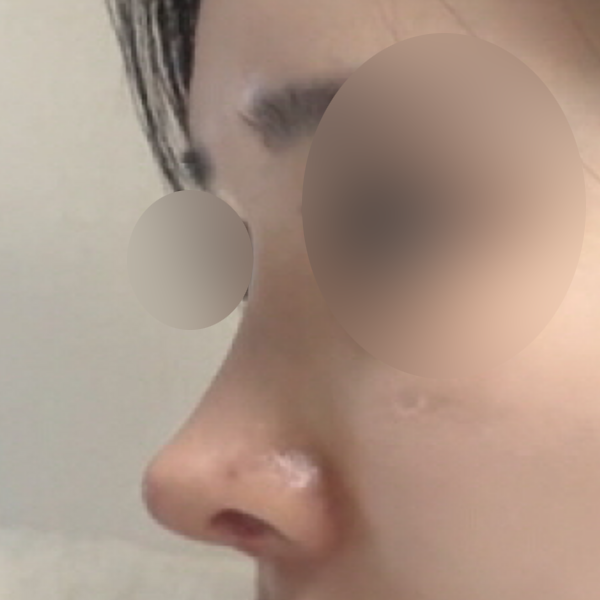 수술 전 후