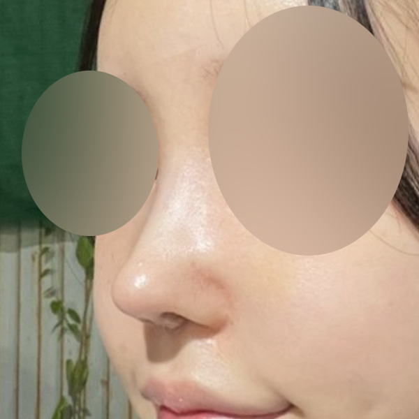 수술 전 후