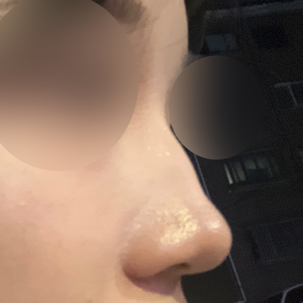 수술 전 후