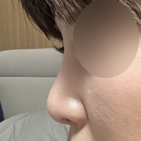 수술 전 후