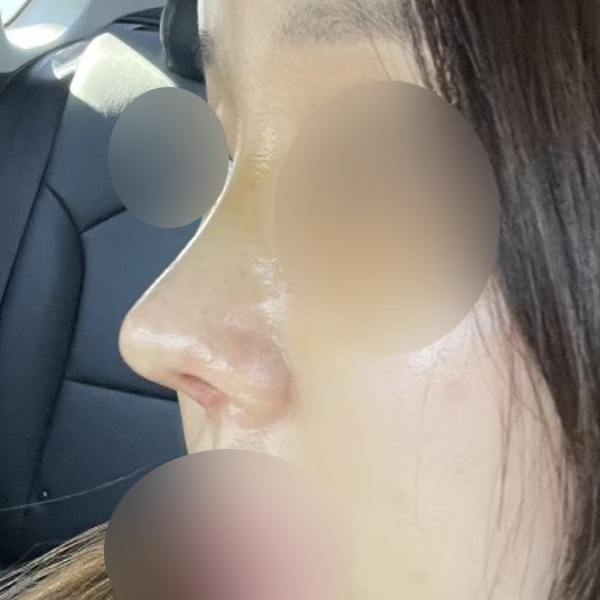 수술 전 후
