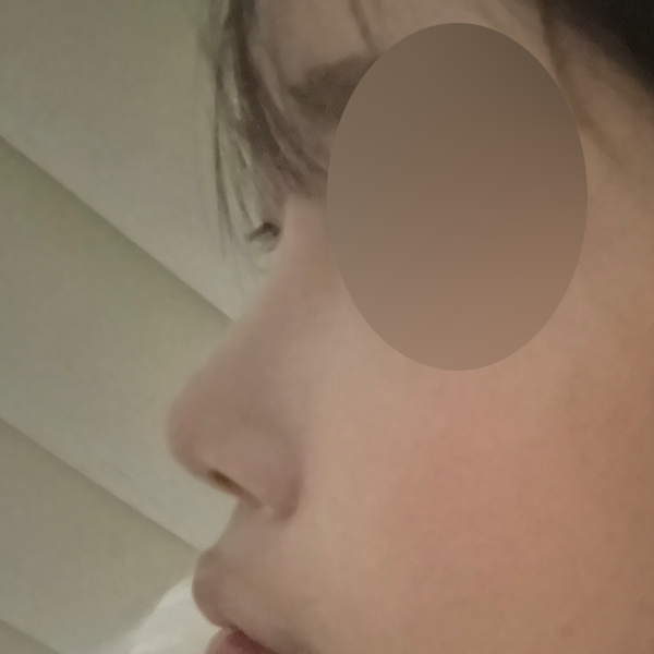 수술 전 후