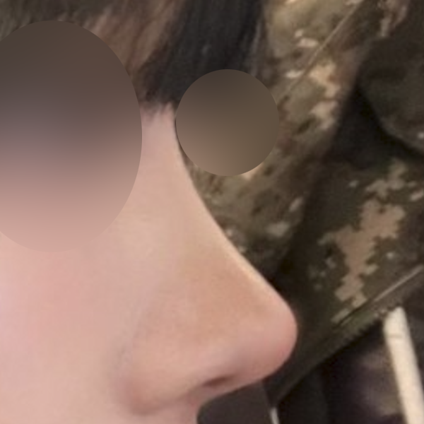 수술 전 후