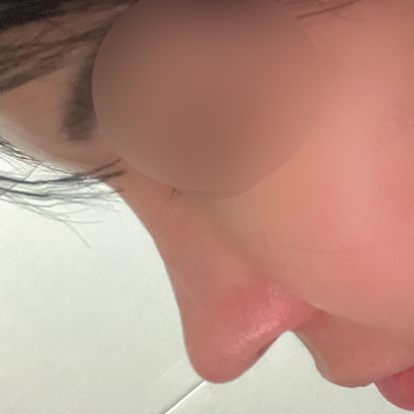수술 전 후