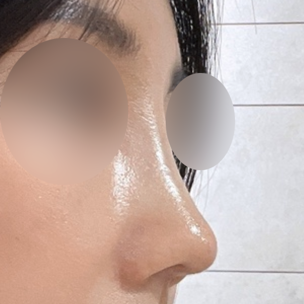 수술 전 후
