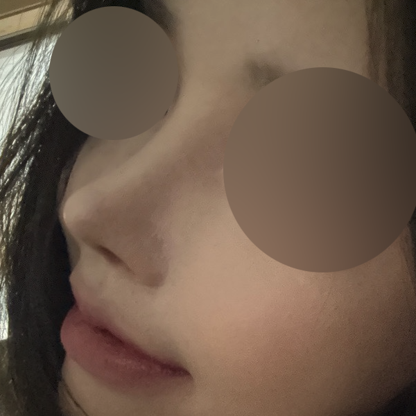 수술 전 후