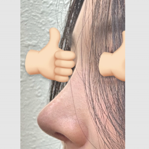 수술 전 후