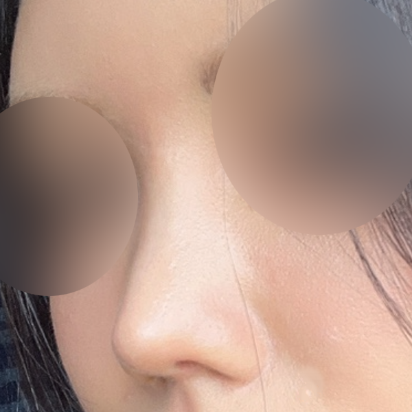 수술 전 후