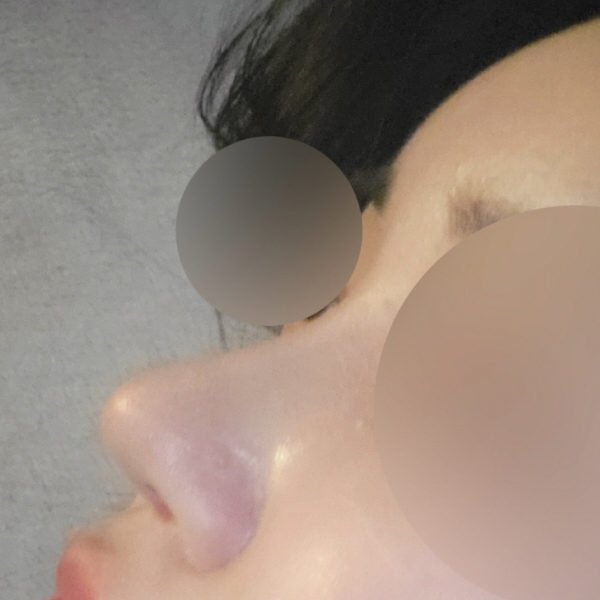 수술 전 후
