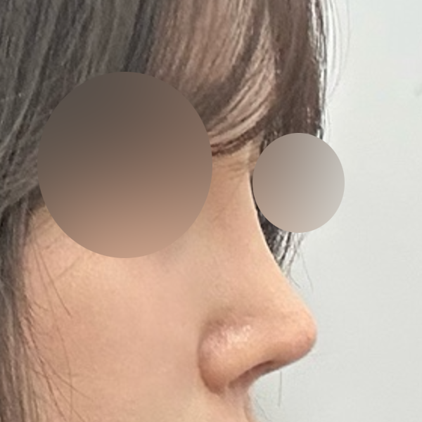 수술 전 후