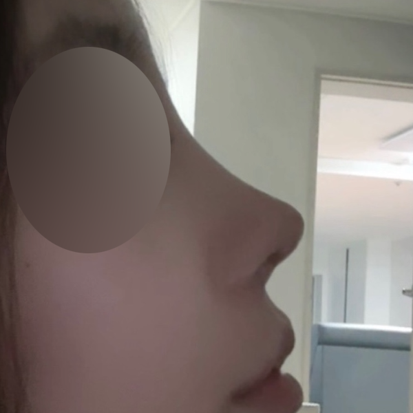 수술 전 후