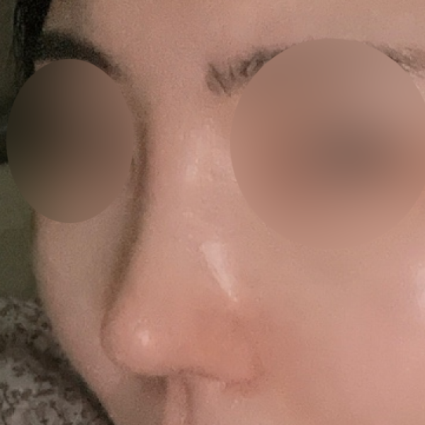 수술 전 후