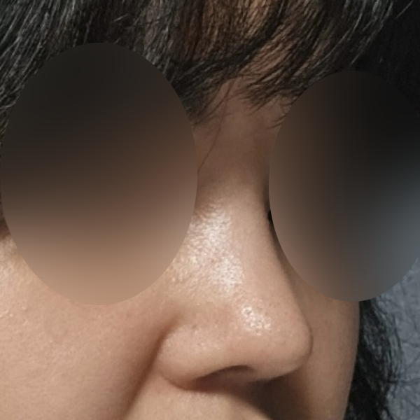 수술 전 후