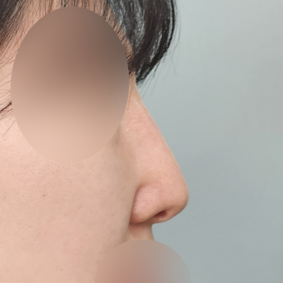 수술 전 후