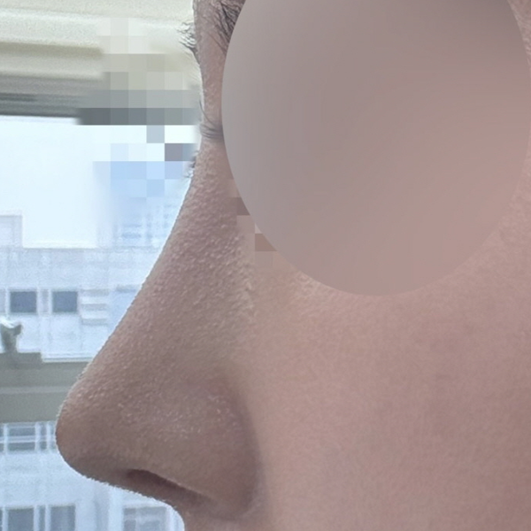수술 전 후