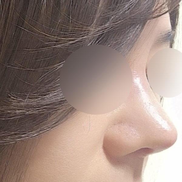 수술 전 후