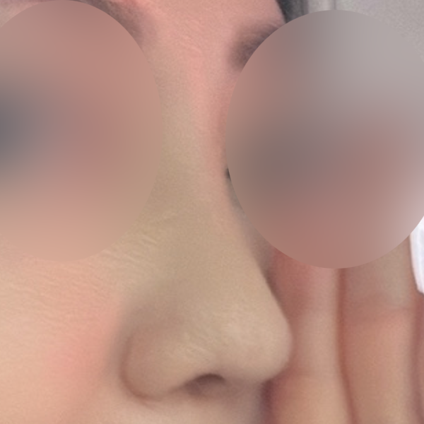 수술 전 후