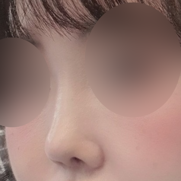 수술 전 후