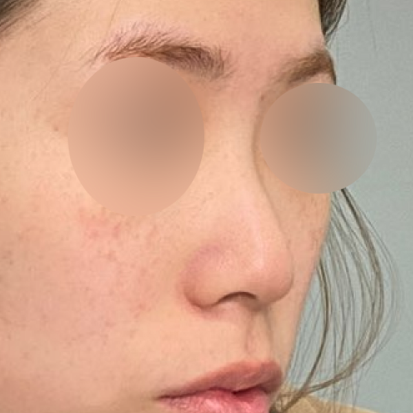 수술 전 후