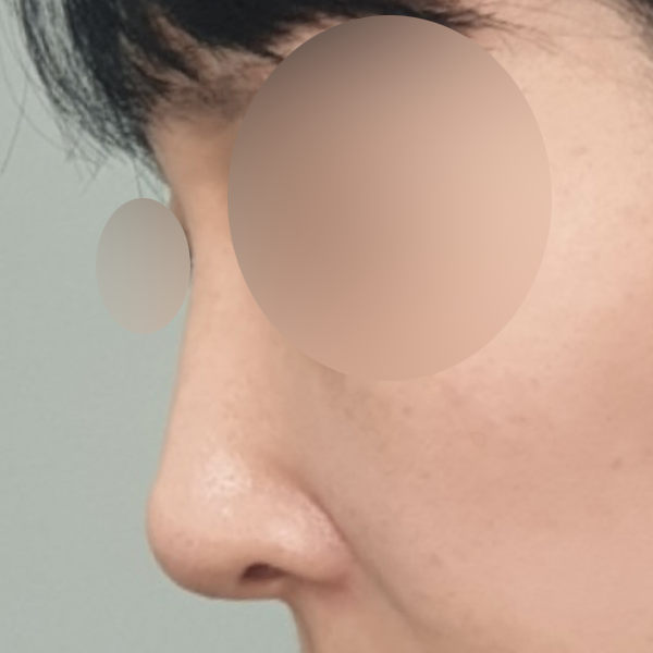 수술 전 후