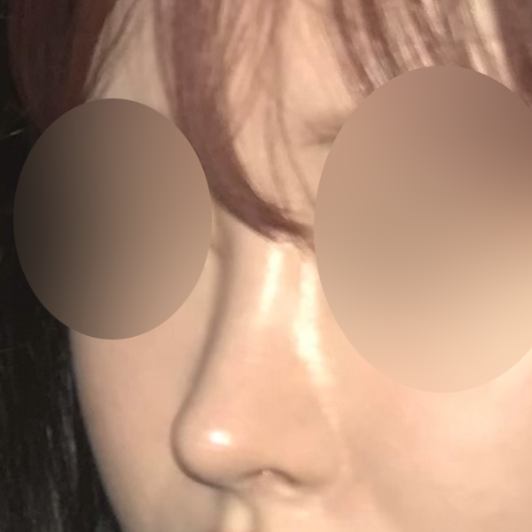 수술 전 후